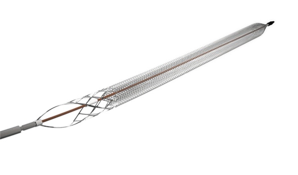 ClotTriever catheter