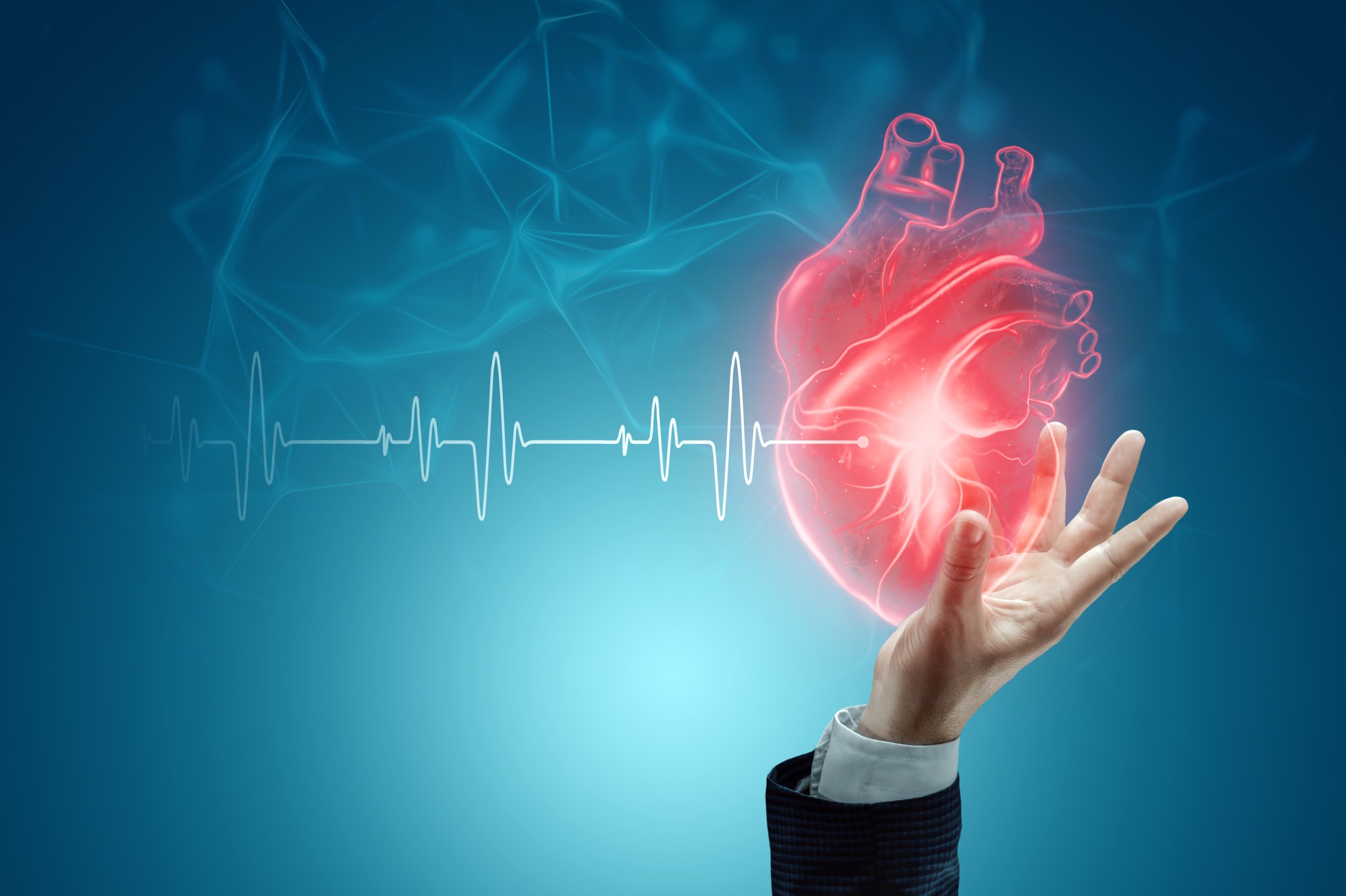 Terumo Europe